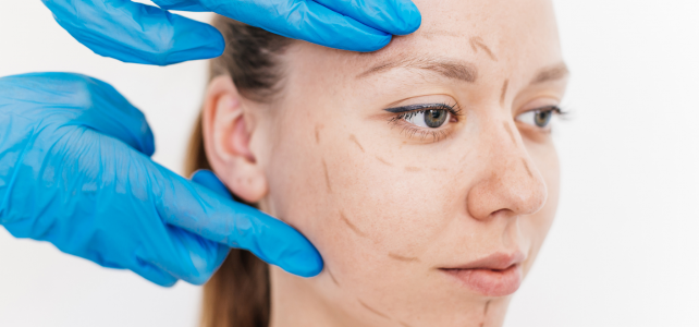 plastiskais ķirurgs plāno deguna korekciju sievietei